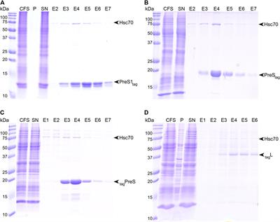 Phosphorylation of the Hepatitis B Virus Large Envelope Protein